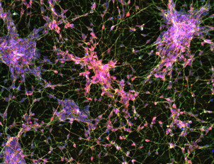 ioGABAergic Neurons™