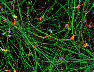 ioGlutamatergic Neurons HTT 50CAG/WT™