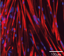 bit.bio ioSkeletal Myocytes Desmin DAPI