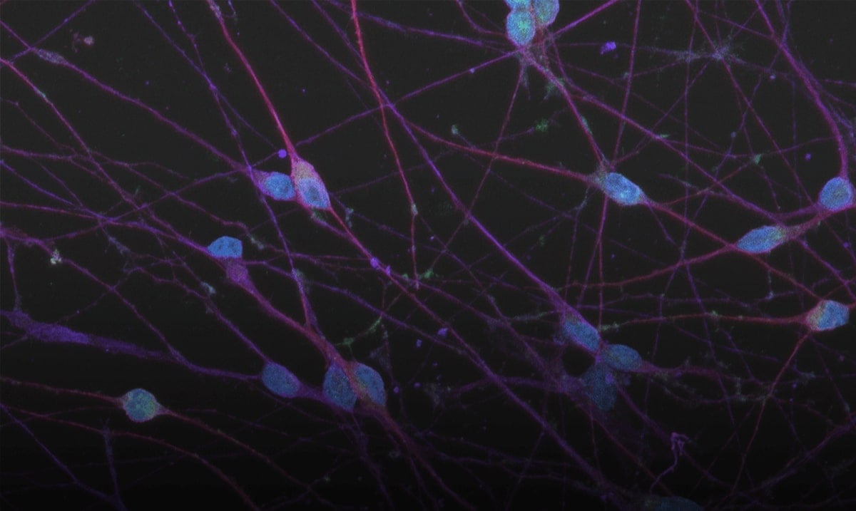 Modelling human neurodegenerative diseases in research & drug discovery