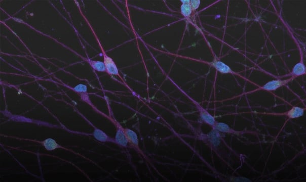 Modelling human neurodegenerative diseases in research & drug discovery