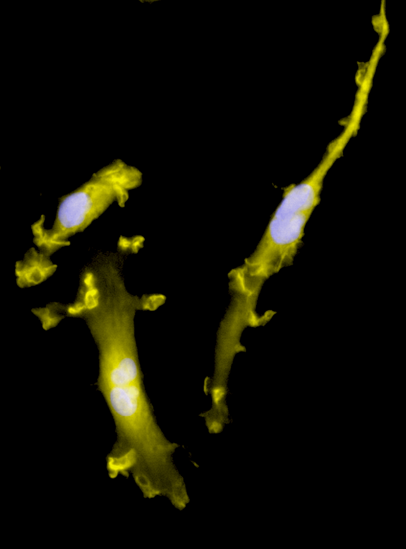 CRISPR-Ready ioMicroglia