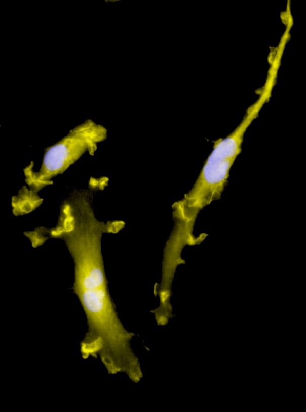 CRISPR-Ready ioMicroglia