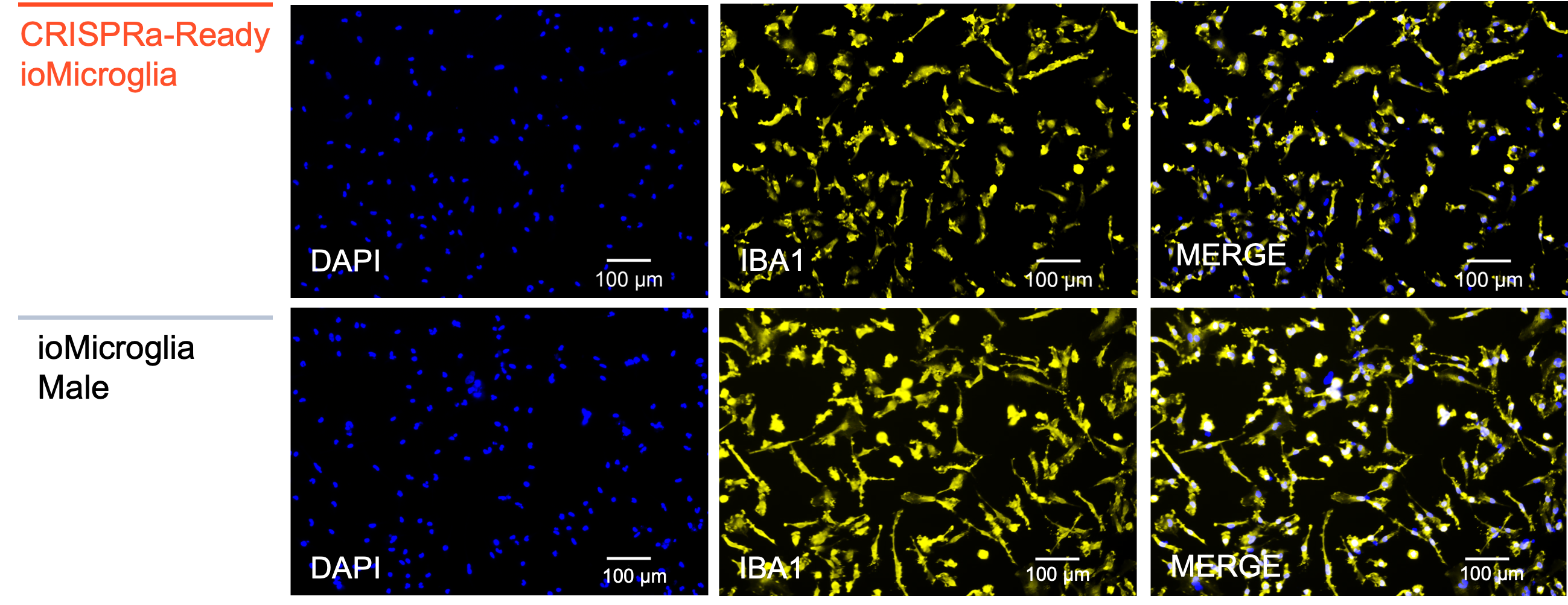 CRISPRa microglia IBA1 ICC