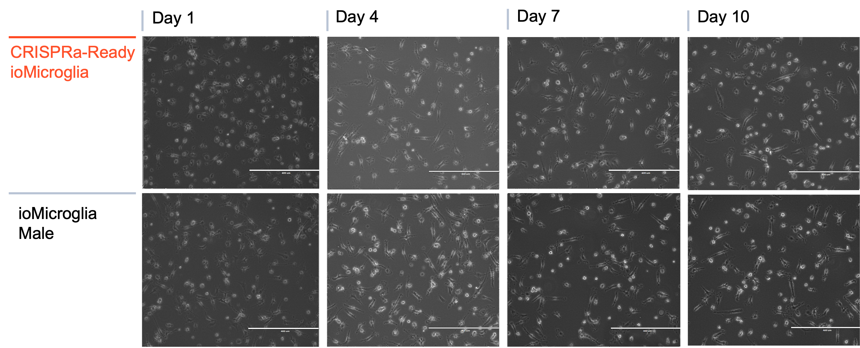 CRISPRa microglia brightfield