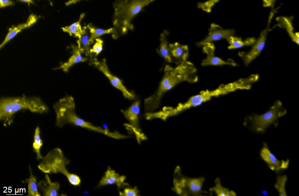 CRISPRa-Ready ioMicroglia User Manual