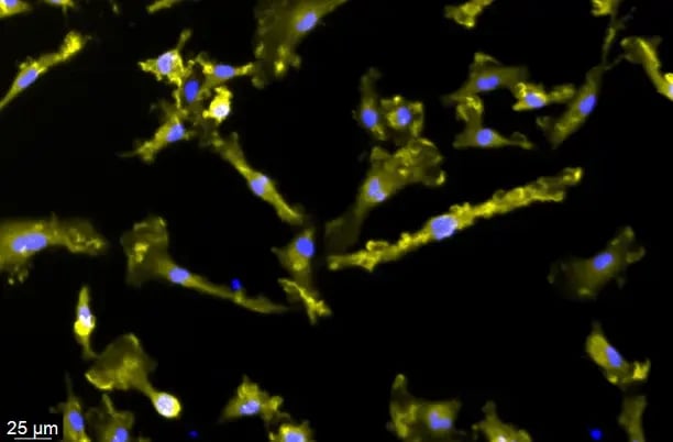 NEW! CRISPRa-Ready ioMicroglia Male