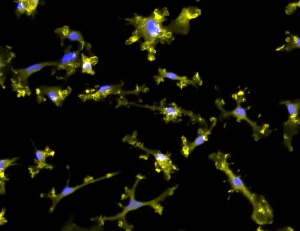 Lentiviral transduction of ioMicroglia | bit.bio