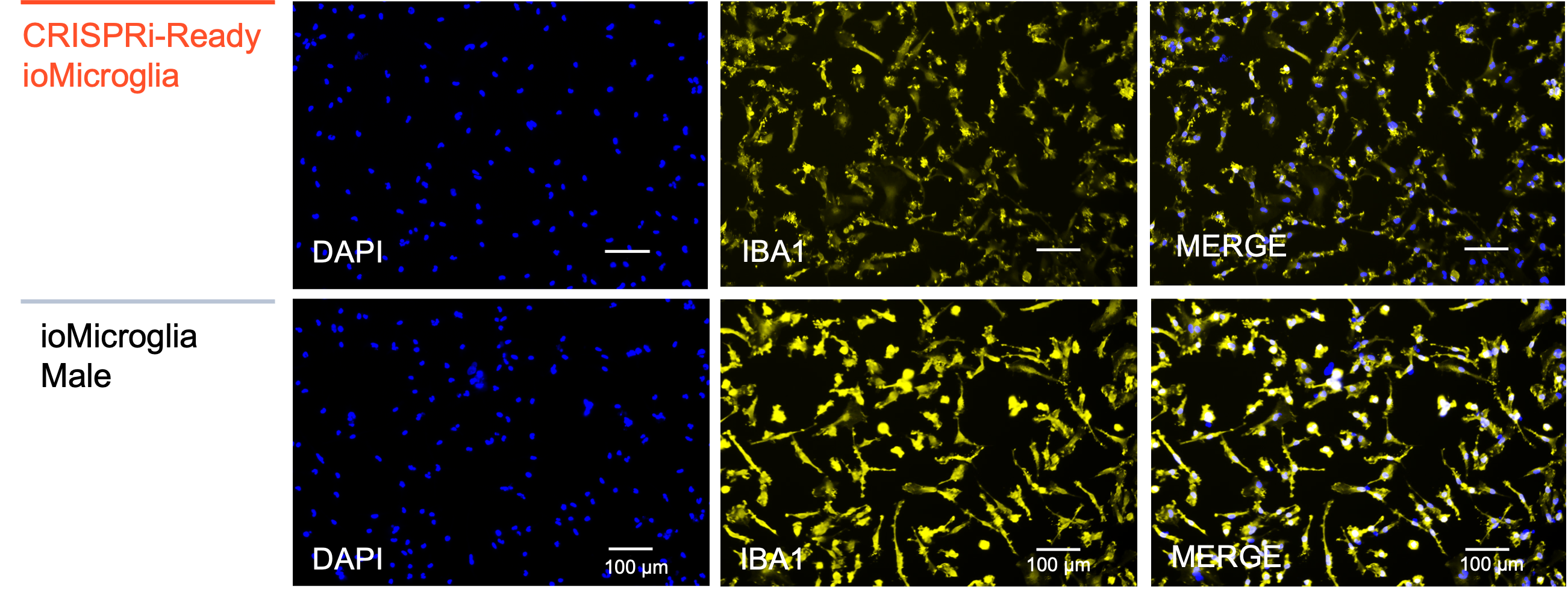 CRISPRi microglia IBA1 ICC characterisation