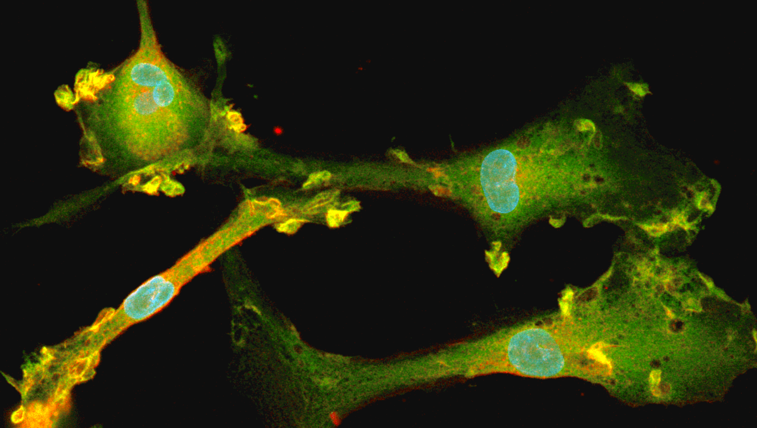 Rapid and consistent generation of functional microglia from reprogrammed hiPSCs to study neurodegeneration and neuroinflammation