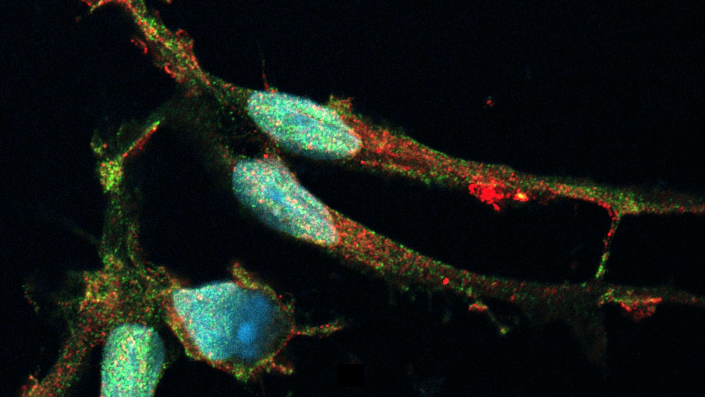 ioMicroglia iPSC-derived microglia generated with precision reprogramming and imaged with immunofluorescent staining