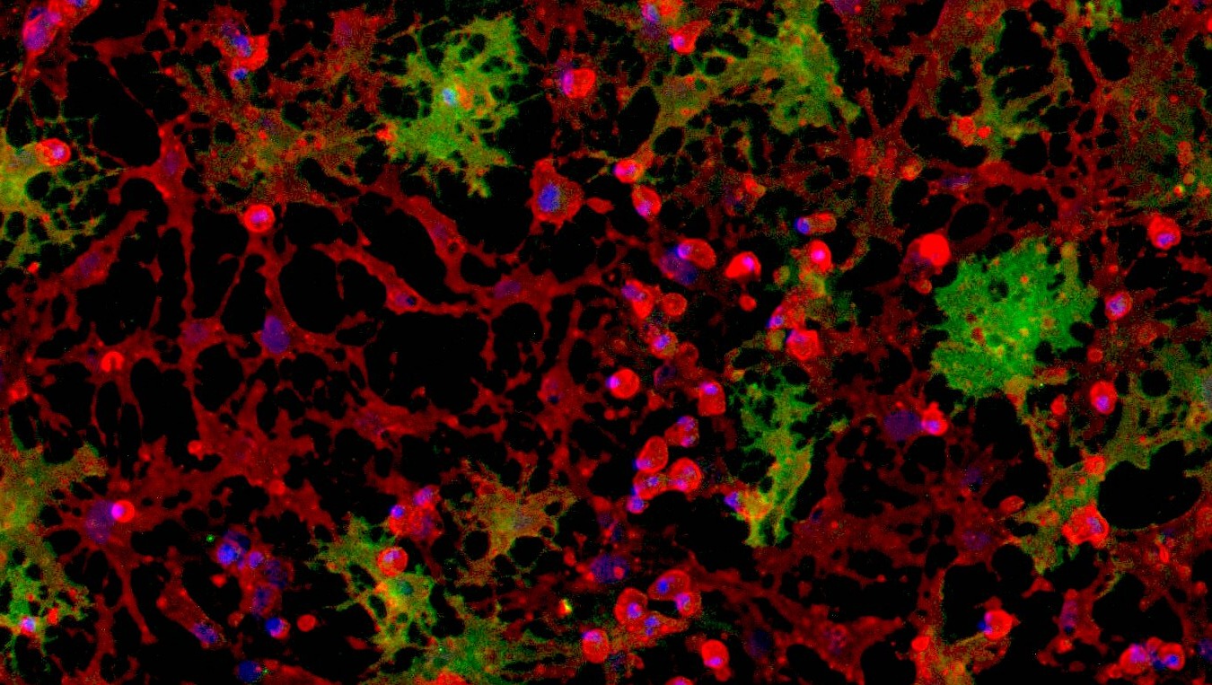 ioOligodendrocyte-like cells
