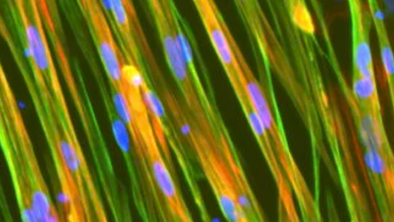 Research in Motion with ioSkeletal Myocytes email header