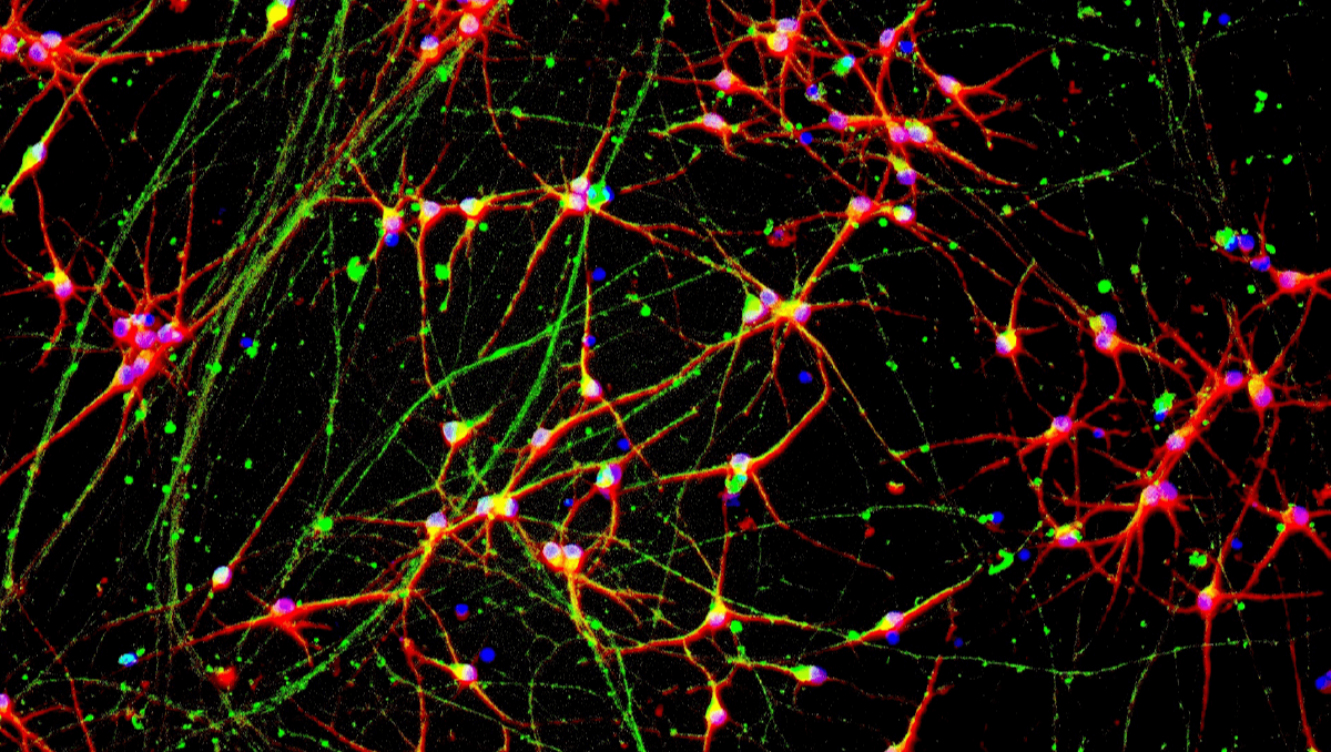 Running Large-Scale CRISPR Screens in Human Neurons