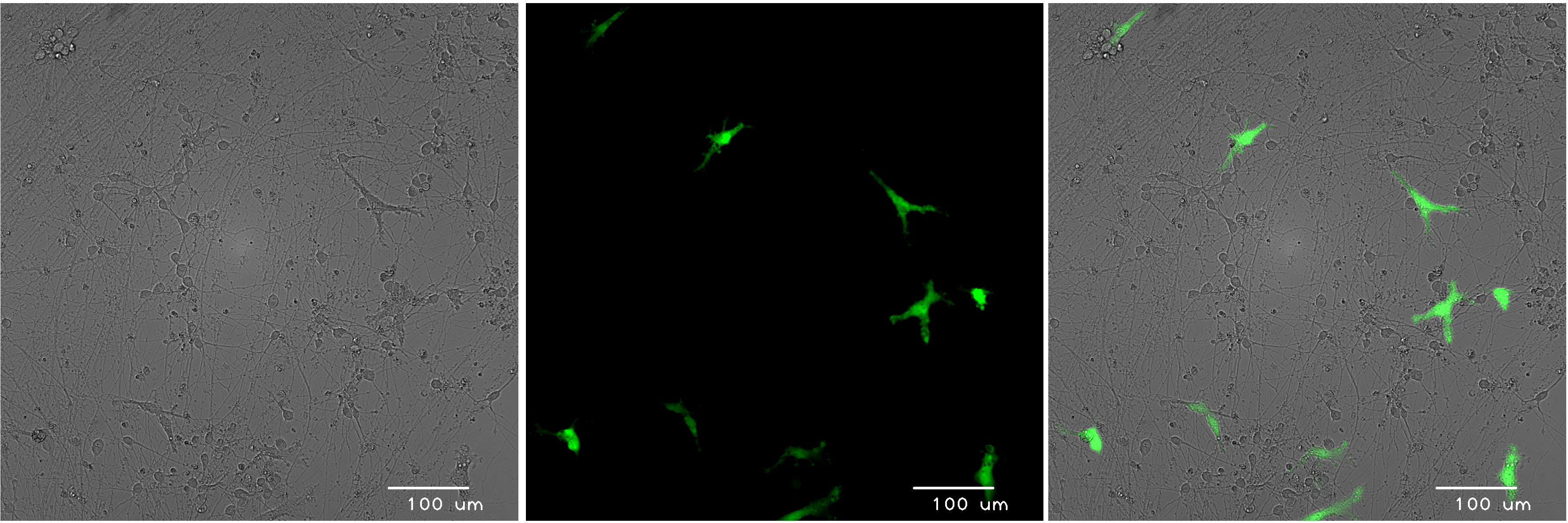 bitbio-co-culture-GFP-microglia-glutamatergic-neurons