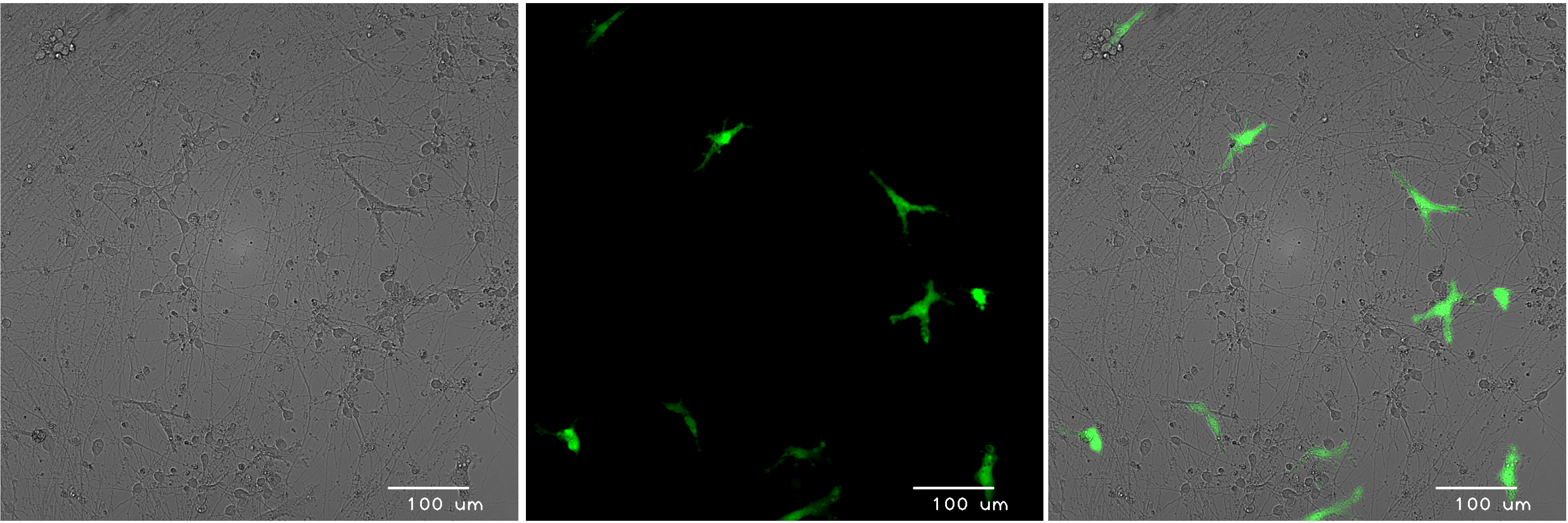 bitbio-co-culture-GFP-microglia-glutamatergic-neurons