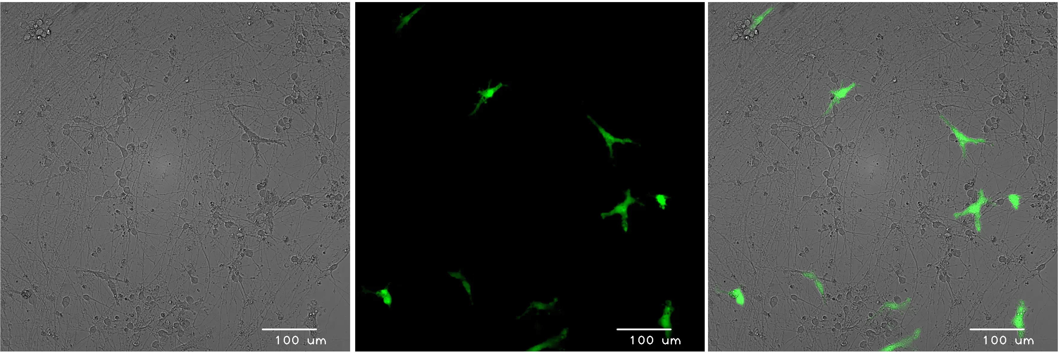 bitbio-co-culture-GFP-microglia-glutamatergic-neurons