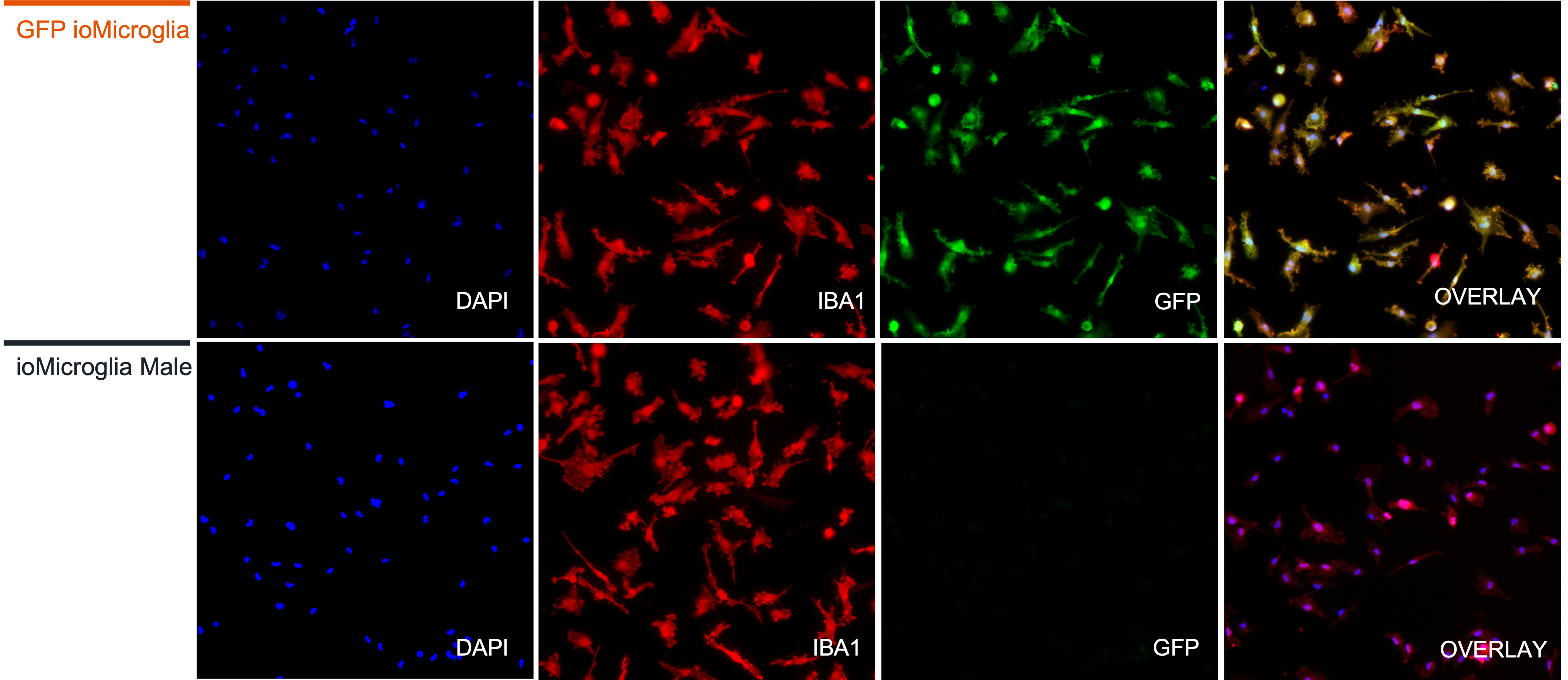 immunofluorescence images of gfp microglia marker iba1