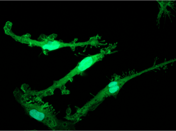 Generation of an immunocompetent neural assembloid model