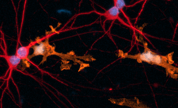 Alzheimer’s Disease Pathogenesis: Emerging Role of Microglia