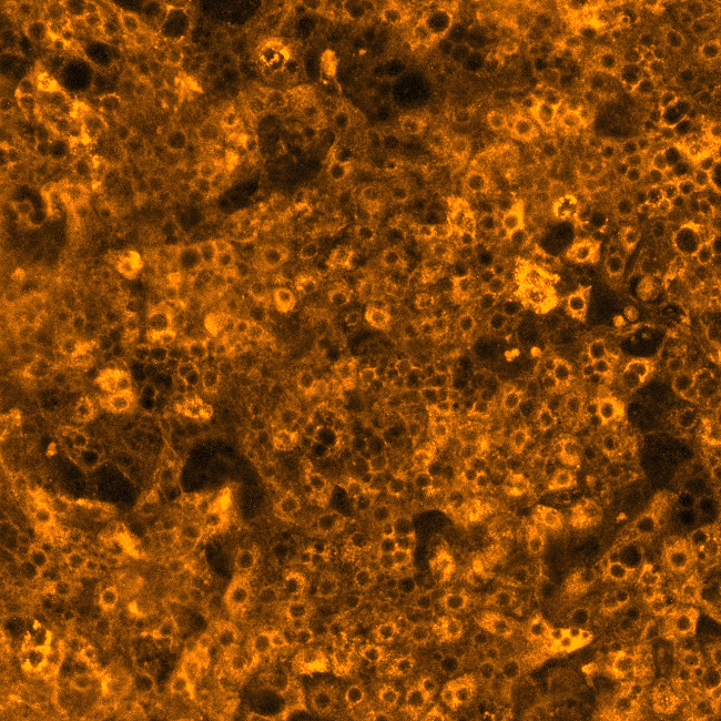 Principles, pitfalls, and progress in modelling human liver toxicity and pharmacology in vitro