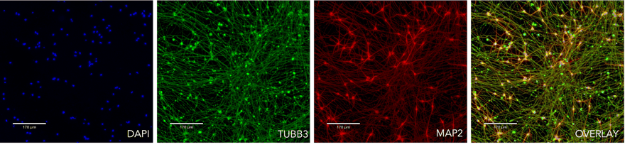 ICC showing MAP2 TUBB3 DAPI on the TDP-43 isogenic control