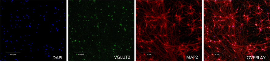 ICC showing MAP2 VGLUT2 DAPI on the TDP-43 isogenic control