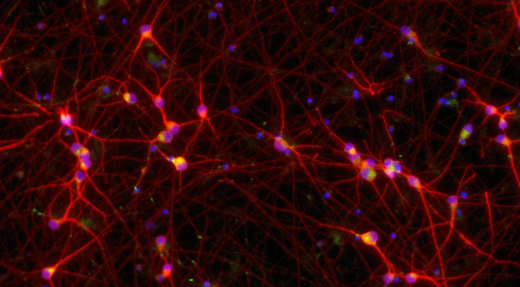 ioGlutamatergic Neurons TDP-43 M337V™