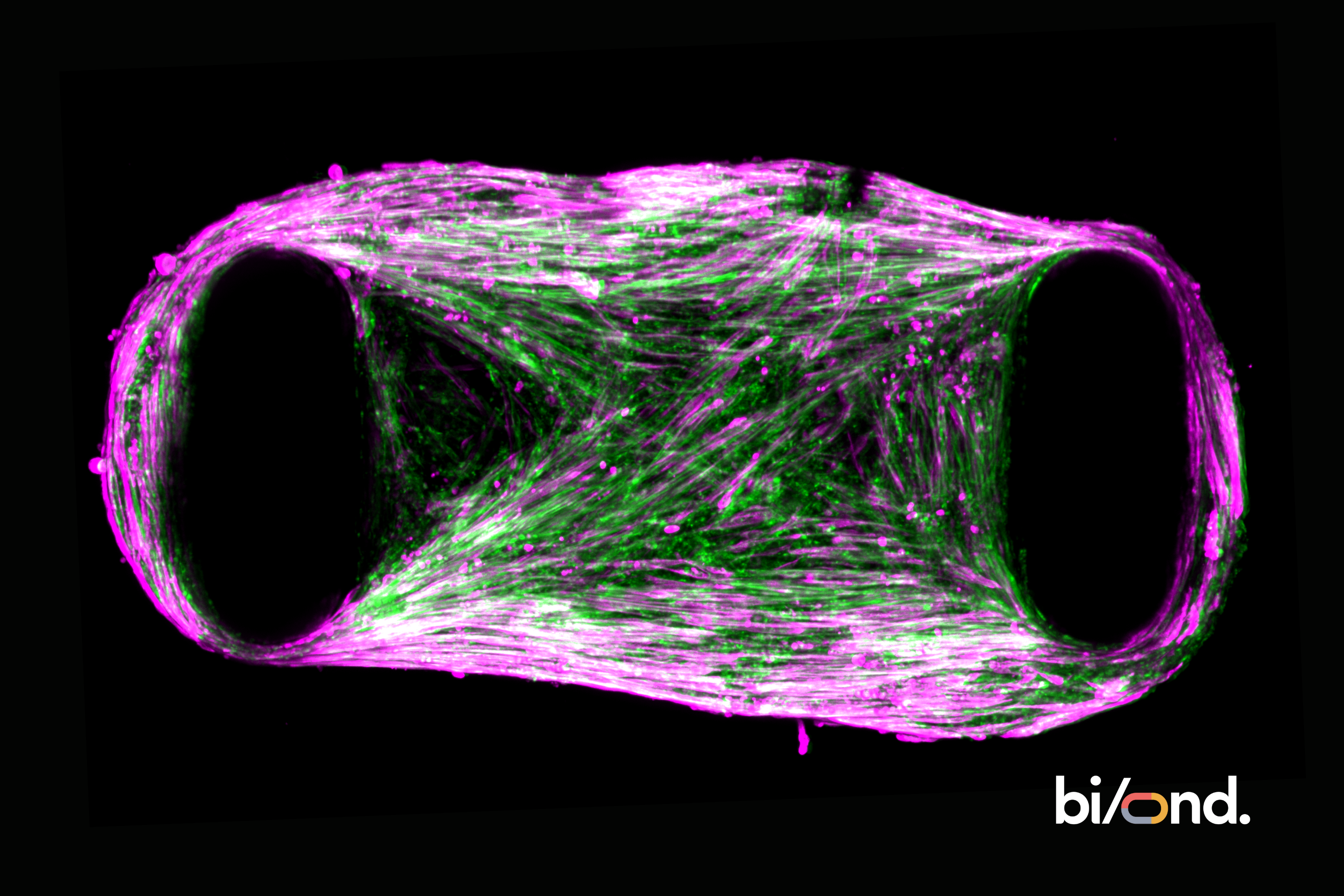 Skeletal Myocytes | ioCells