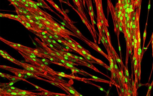 bit.bio’s Human iPSC-derived skeletal myocytes
