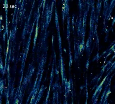 iPSC-derived skeletal myocytes show spontaneous calcium waves