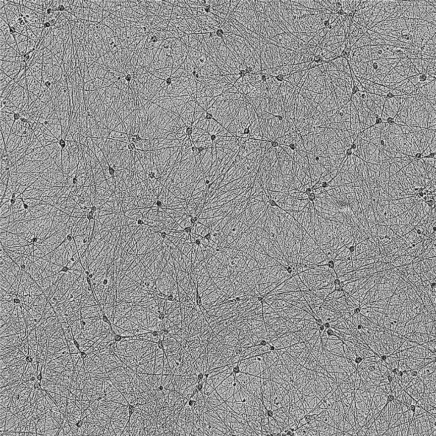 bit.bio_ioMotorNeurons_io1027_Brightfield_DIV41_A (1)