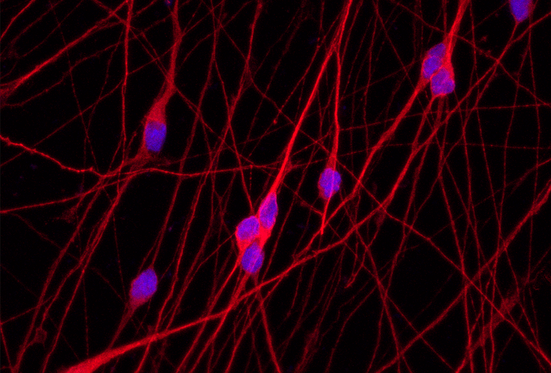 Cell culture hacks for ioGlutamatergic Neurons