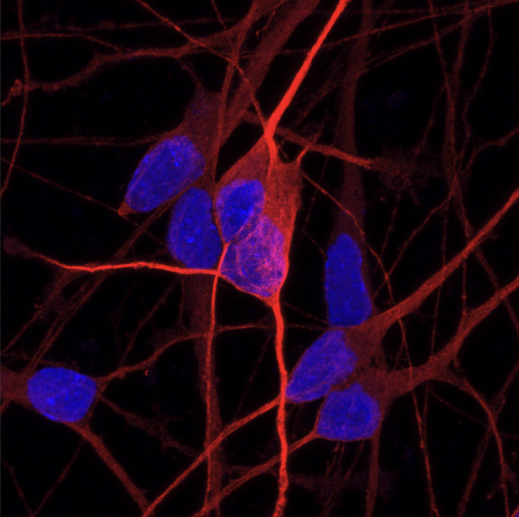 ioGlutamatergic Neurons GBA null/WT™