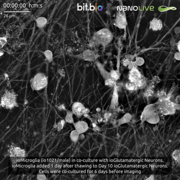 ioMicroglia_io1021- male_in co-culture with ioGlutamatergic Neurons_ioMicroglia seeded at day 1 post-thaw.mp4