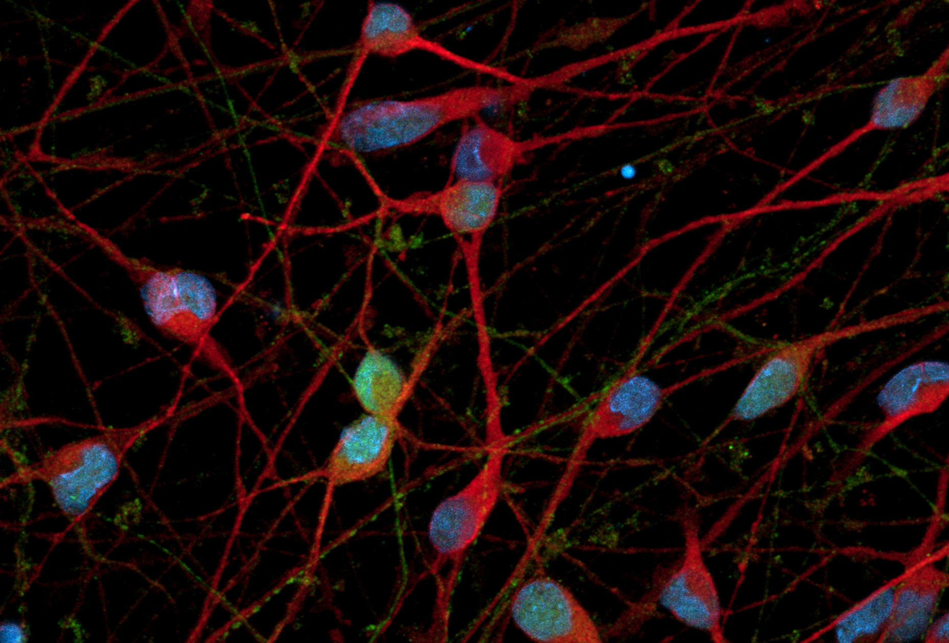 Unlocking the Potential of RNA Therapies in ASD: How Definitive Human iPSC-derived Cells are Paving the Way