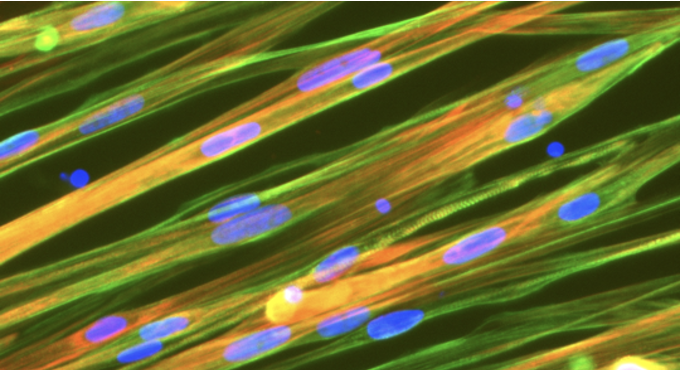 ioSkeletal Myocytes_for partners module