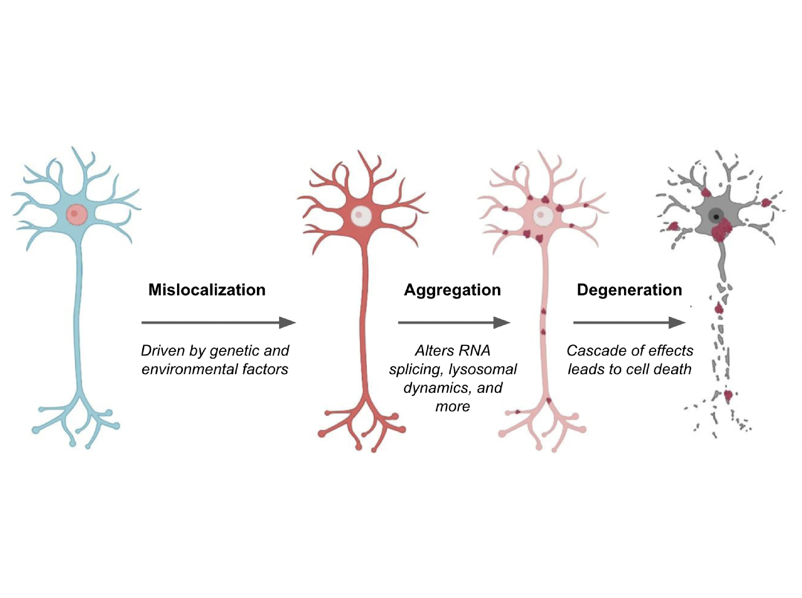 Degenerating neurons