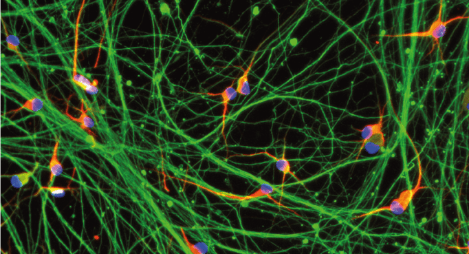 Discover ioCells portfolio ICC ioDisease model cells