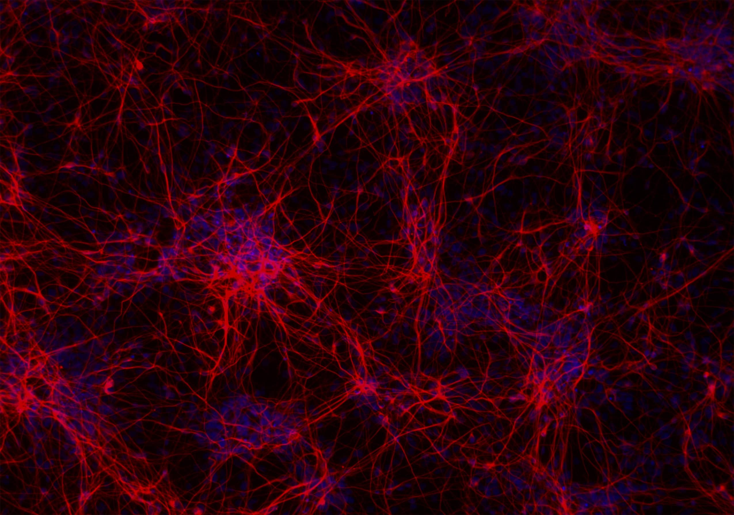 ioGlutamatergic Neurons™ and related disease models