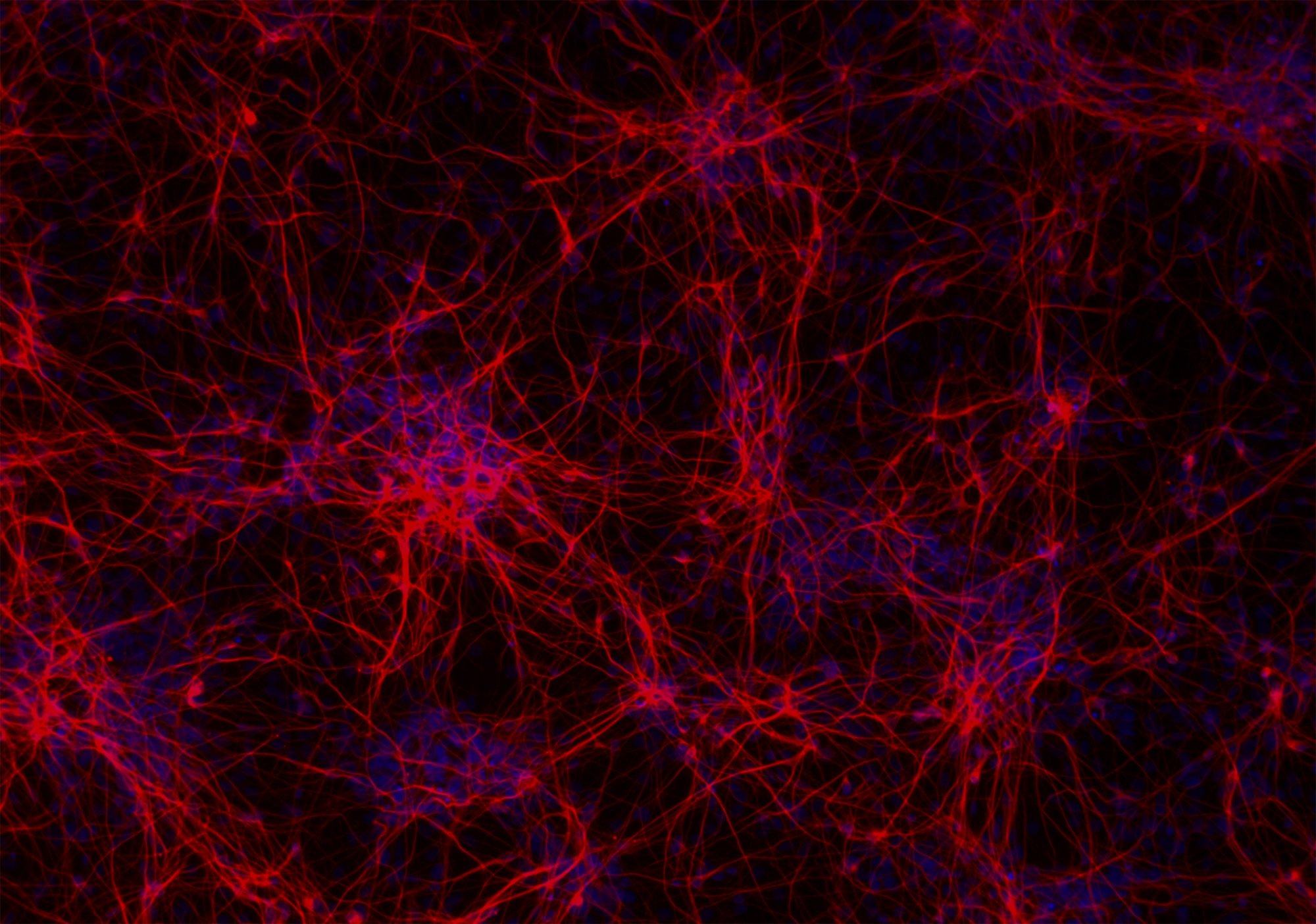 bit.bio-ioGlutamatergic-Neurons-Day-14-Beta-III-Tubulin-staining