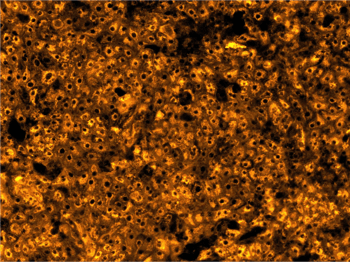 bit.bio launches Early Access programme for ioHepatocytes, a new iPSC-derived liver model