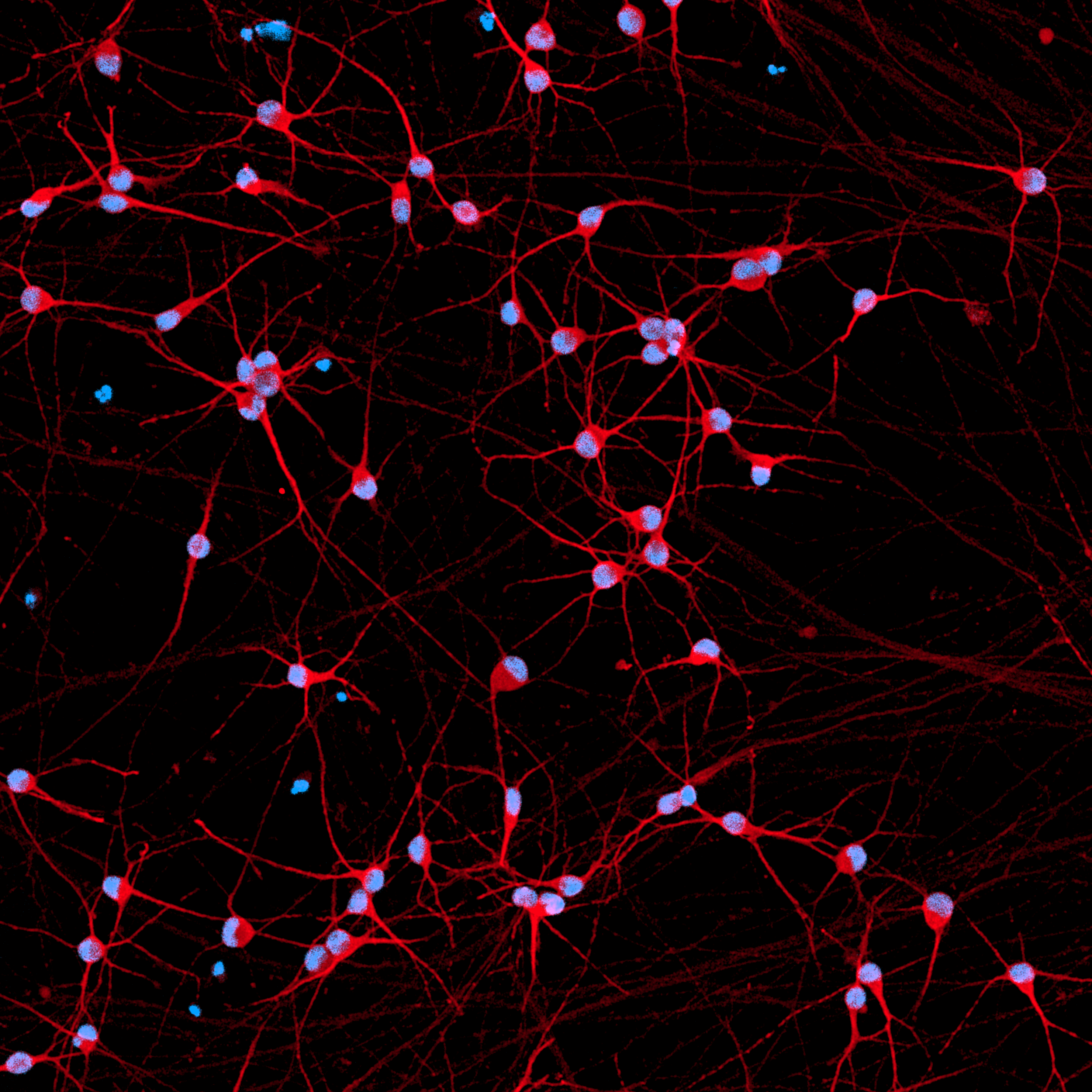 ioGlutamatergic Neurons PINK1 Q456X/Q456X™