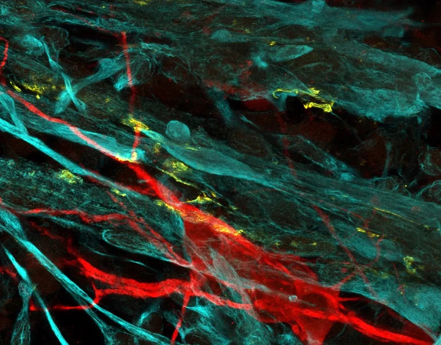 Human iPSC-derived skeletal myocytes and motor neurons in co-culture.