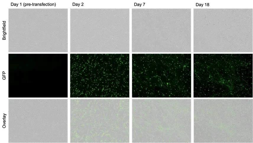 mRNA transfection of human iPSC-derived neurons with GFP.