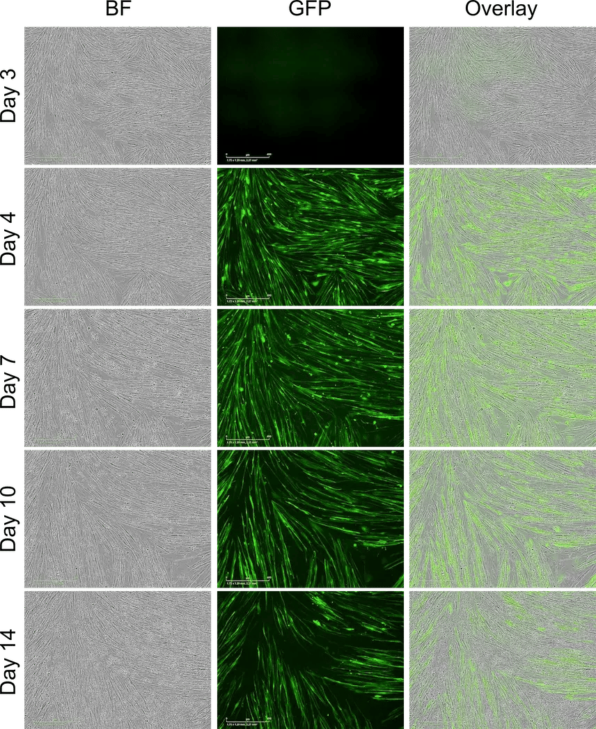 mRNA transfection of human iPSC-derived skeletal myocytes with GFP.