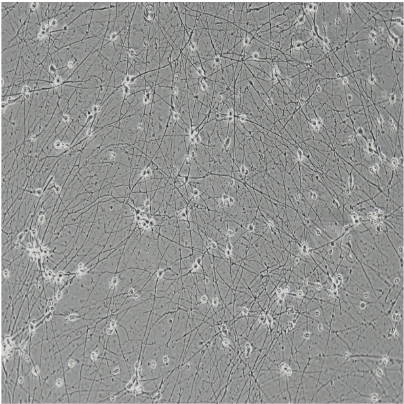 bit.bio iPSC-derived glutamatergic neurons morphology brightfield day 7