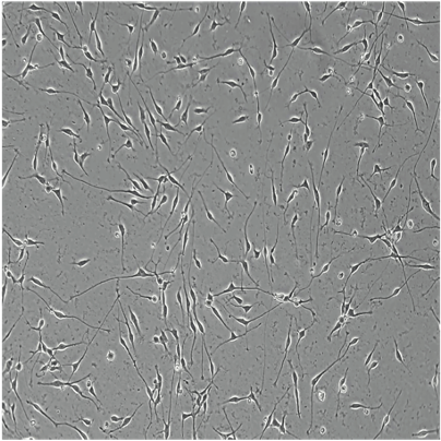 bit.bio iPSC-derived glutamatergic neurons morphology brightfield day 1