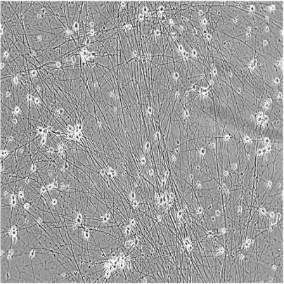 bit.bio iPSC-derived glutamatergic neurons morphology brightfield day 11
