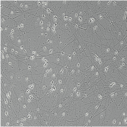 bit.bio iPSC-derived glutamatergic neurons morphology brightfield day 4